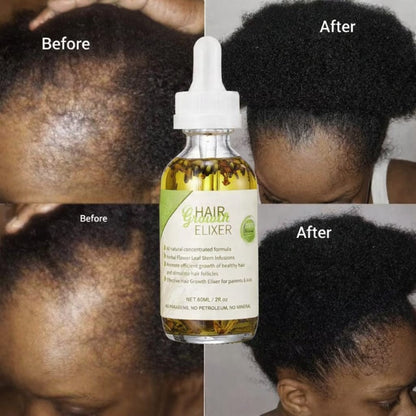 Rosemary & Castor Hair Growth Oil